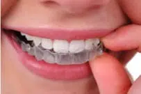 Invisalign in Bergen County, NJ