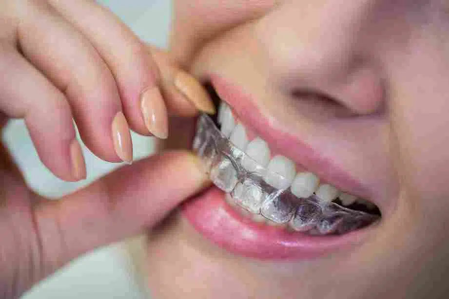 Is Invisalign right for you