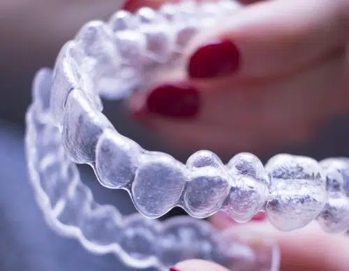 Invisible Teeth Aligners