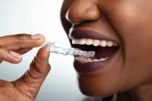 orthodontist West Orange