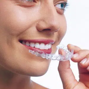 clear aligners near me