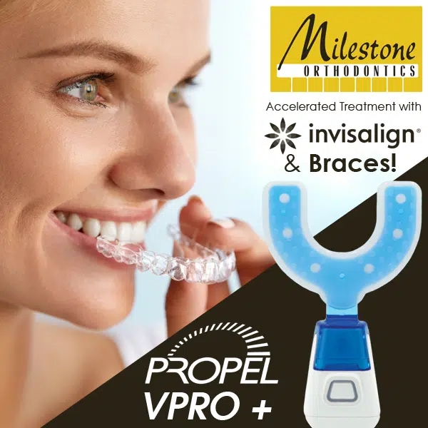 Propel VPro +
