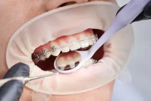 orthodontist in Rutherford