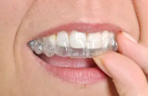 invisalign aligners everything you need to know west orange nj