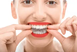 invisalign orthodontist in rochelle park nj