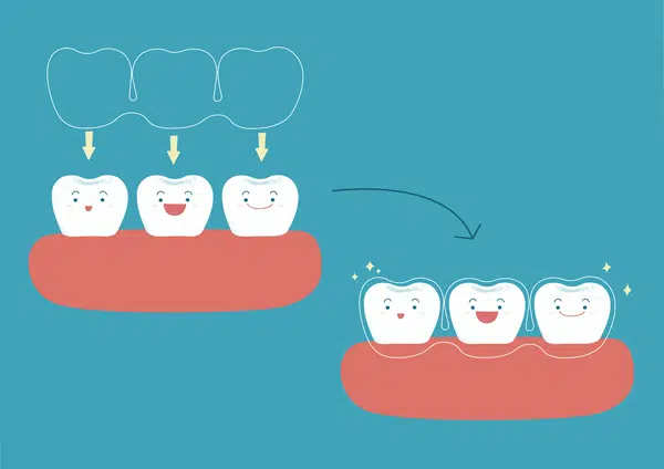 orthodontist-pointing-at-invisalign-image