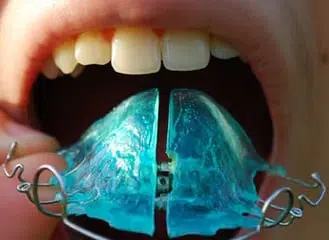 retainer west orange