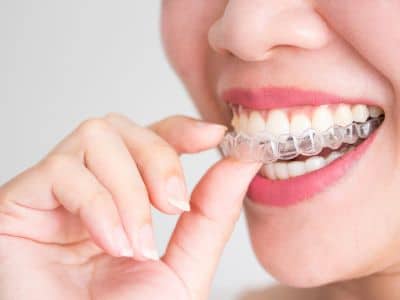 what foods can i eat with invisalign